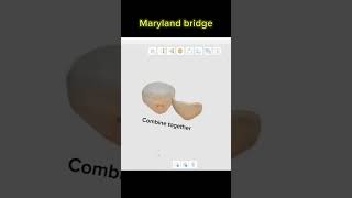 dentist meshmixer maryland partialdenture Meditapp Meditdesign Meditacademy [upl. by Nottirb]