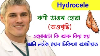 Hydrocele Causes Sign and Symptoms and Treatment  Ayurvedic and Allopathic Medicine of Hydrocele [upl. by Amandie781]