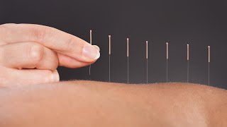 The Science Behind How Acupuncture Helps Relieve Pain A Doctor Of Chinese Medicine Explains [upl. by Joash]