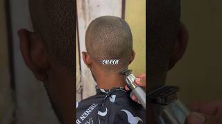 💈✂️La solución para los CALVOS barbero barbershop calvos [upl. by Irah319]