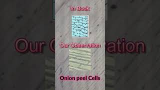 Cells Under Microscope Ovum Cells Muscle Cells Onion Peel Cells and Blood Cells  LP [upl. by Enirehtak]