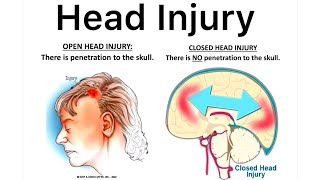 Head Injury Cause Symptom Diagnose Treatment What Is Head Injury What is Brain injuryHead Injury [upl. by Sutsuj576]