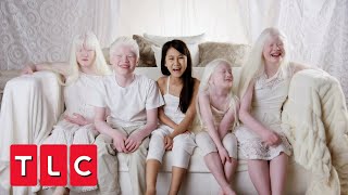 This Couple Adopted Four Children With Albinism  Born with Albinism [upl. by Petuu]