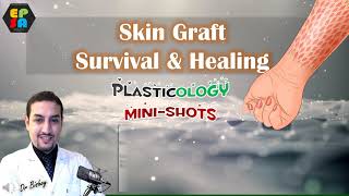 Plasticology Skin Graft Take  Survival amp Healing Intro [upl. by Adnohryt]