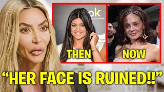 Kim Kardashian EXPOSES Kylie Jenner’s BOTCHED Plastic Surgery [upl. by Yelik]