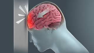 How Traumatic Brain Injury TBI Affects Brain Cells  New Research Could Lead to New Treatments [upl. by Korney]