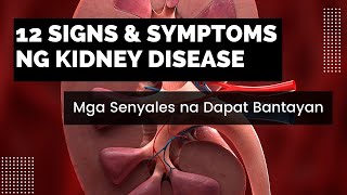 12 Signs and Symptoms ng Kidney Disease [upl. by Aiekram864]