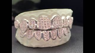 Custom Gold Grillz Solid 925 Sterling Silver Iced Out Grillz with Frames [upl. by Dasie]