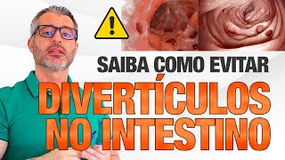 O que você precisa saber para não ter uma DIVERTICULITE [upl. by Silloh]