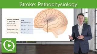 Stroke Pathophysiology  Clinical Neurology [upl. by Kalinda941]