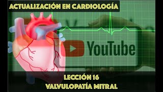 16 VALVULOPATÍA MITRAL [upl. by Elohcim]