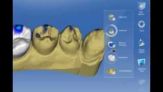 Sirona CEREC SW 40 Tool Konzept [upl. by Barden]