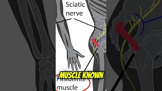 Physical Therapy Not Helping Sciatica Heres One Reason Why [upl. by Deina]