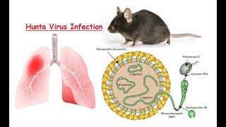 True World Affairs  Hantavirus The Silent Threat in 2024 [upl. by Tabbi]