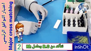 اختبار تطابق crossmatching نقل الدم ، وأنواع التوافق yousiftubelab2094 [upl. by Ailekat]