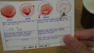 Finding Out My Blood Type [upl. by Paderna]