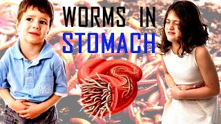 How To Prevent Your Child From Stomach Worms  worms in kids  Parasite treatment in hindi [upl. by Stesha]