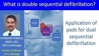 What is double sequential defibrillation [upl. by Alekat277]