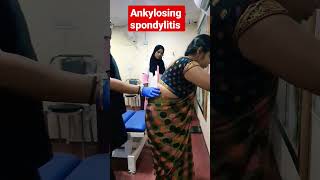 Ankylosing spondylitis treatment 93085113578409313131 drrajneeshkant [upl. by Secundas901]