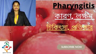 Pharyngitis In Bangla  Causes  Treatments  Home Remedies [upl. by Henig]