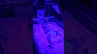 Phototherapy of baby baby nicu cutebaby [upl. by Nwahsad571]