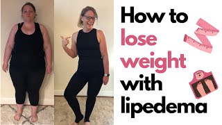 How to Lose Weight With Lipedema [upl. by Inattyrb522]