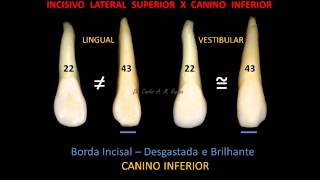 Anatomia Caninos [upl. by Enitsahc762]