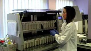 How Do You Process a Cytology Sample  Francesca Albertini [upl. by Engamrahc]