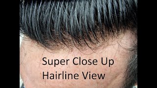 Hair System Fitting Video Bleached Knots Graduated Hairline Close up Hairline shots [upl. by Anawat]