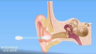 Forget QTips — Here’s How You Should Be Cleaning Your Ears [upl. by Airaet718]