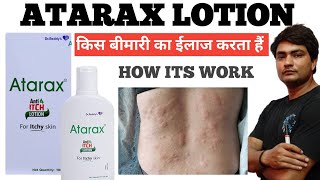 atarax anti itch lotion why doctor is suggesting and how its work and its use [upl. by Edwin674]