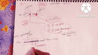 Brain herniation part 1kernohans notch phenomenonuncal herniation [upl. by Aietal]