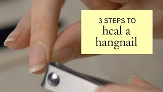 3 Steps to Heal a Hangnail [upl. by Rustice698]