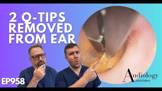 2 QTIPS REMOVED FROM EAR  EP958 [upl. by Oicnedurp]