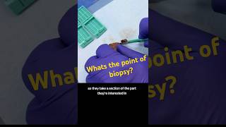 Whats the point of a biopsy humananatomy histology medicine histotechnology [upl. by Sidell]