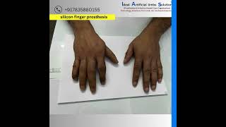 9205723927 Silicon finger prosthesis [upl. by Sibley]