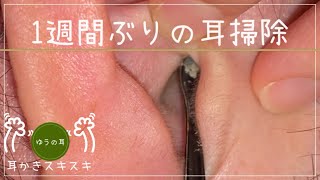 【耳かき】1週間ぶりの耳掃除【ear cleaning】 [upl. by Adnolay]