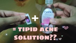 VLOG23  Cheap Acne Solution  Dalacin C and Eskinol  Tipid Skin Care [upl. by Gnilrets]