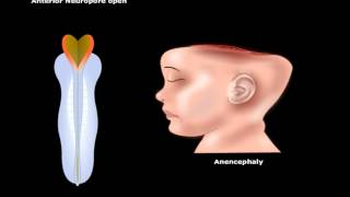 USMLE® Step 1 Neuroscience Development of CNS Animation [upl. by Notecnirp]