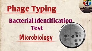 Phage Typing ll Bacterial identification test ll Microbiology [upl. by Hamlet]