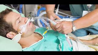 endotracheal intubation [upl. by Ahsekal]