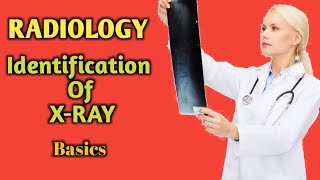 PART1  Radiology  Anatomy  How to study radiology chapter X Ray description  NIH KOLKATA BHMS [upl. by Ayerdna916]