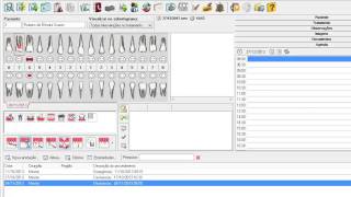 Odontograma Inteligente [upl. by Anaitsirk]