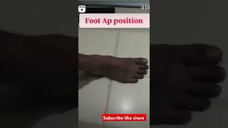 foot XRay ap view position please subscribe my channel medicalimaging [upl. by Assirok]