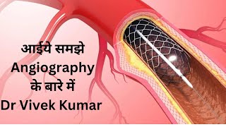 Lets understand Angiography CAG  Dr Vivek Kumar [upl. by Worlock780]