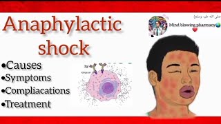 Anaphylactic shockits causessymptoms and treatmentviralvideomedicalmedicineanaphylaxis fyp [upl. by Urana]