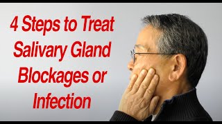 4 Steps to Treat Salivary Gland Swelling at Home [upl. by Sigismund455]