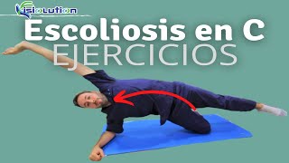 ESCOLIOSIS en quotCquot  EJERCICIOS y RECOMENDACIONES  Fisiolution [upl. by Studdard]