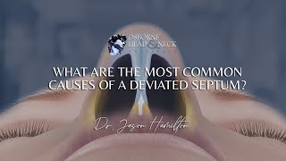 What are the most common causes of a deviated septum [upl. by Darrow]