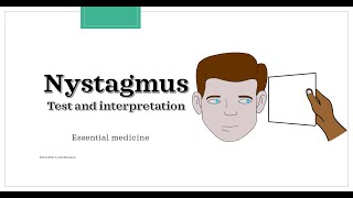 Nystagmus  test and interpretation Essential medicine [upl. by Halford160]